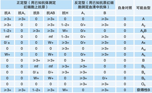 【試驗?zāi)康暮驮怼? ABO血型鑒定是通過檢測被檢者紅細(xì)胞上是否存在A和/或B抗原（正定型）以及被檢者血漿中是否存在抗A和/或抗B抗體（反定型）來確定。 對于成年個體被檢者，紅細(xì)胞上的A和/或B抗原與血漿中的抗A和/或抗B抗體存在一種對應(yīng)關(guān)系。其獨特性質(zhì)在于：紅細(xì)胞上缺乏A和/或B抗原，則血清中存在與所缺乏的抗原對應(yīng)的強(qiáng)反應(yīng)性抗體，如紅細(xì)胞上缺乏A抗原，則可以預(yù)見血漿中存在抗A抗體。 常規(guī)的ABO定型必須包括正定型（紅細(xì)胞定型）和反定型（血漿定型），并將正反定型結(jié)果相互驗證，如果紅細(xì)胞發(fā)生凝集，預(yù)期其凝集強(qiáng)度≥2+；只有正反定型結(jié)果一致時才能準(zhǔn)確定型。 20121212104627668.jpg  然而，有時ABO正定型和反定型會出現(xiàn)結(jié)果不一致現(xiàn)象，或陽性反應(yīng)強(qiáng)度弱于2+。引起正反定型結(jié)果不一致因素有： （一）正定型出現(xiàn)弱反應(yīng)或缺失抗原 1. A亞型、B亞型或AB亞型。 2. 白血病導(dǎo)致A或B抗原減弱。 3. 何杰金病（Hodgkin’s）有時會抑制抗原表達(dá)，與白血病類似。 4. 由于某種疾?。ㄈ绺骨话?、胰腺癌）導(dǎo)致血漿中存在大量的型物質(zhì)，中和抗A或抗B抗體，引起正定型為假陰性或弱陽性。需要將正定型的紅細(xì)胞用生理鹽水洗滌后再次定型可解決此問題。 5. 骨髓移植 6. 非ABO同型輸血 （二）正定型紅細(xì)胞上多余的抗原反應(yīng) 1. 自身凝集紅細(xì)胞、抗體致敏紅細(xì)胞導(dǎo)致。 2. 細(xì)胞未洗滌，血漿蛋白引起的假陽性反應(yīng)。 3. 細(xì)胞未洗滌，血漿中存在針對正定型試劑中某種成分的抗體導(dǎo)致。 4. 骨髓移植。 5. 獲得性B。 6. B（A）現(xiàn)象。 7. ABO非相合輸注。 （三）正定型出現(xiàn)混合視野反應(yīng) 1. 近期輸血。 2. 骨髓移植。 3. 異卵雙胞胎或雙受精卵產(chǎn)生的嵌合體。 4. 胎兒和母體出血。 5. A3亞型。 （四）反定型血清中出現(xiàn)弱反應(yīng)或反應(yīng)缺失 1. 年齡相關(guān)：新生兒以及小于6月齡的嬰兒以及老年人。 2. ABO亞型有亞型抗體，如A2、A2B型人的抗A1。 3. 低球蛋白血癥（如白血病人、使用免疫抑制劑患者、免疫缺陷患者）。 4. 移植患者使用抗排異藥物。 5. 雙胞胎或雙受精卵產(chǎn)生的嵌合體。 （五）反定型出現(xiàn)多余的抗體反應(yīng) 1. 冷自身抗體。 2. 特異性冷同種抗體。 3. 血清中存在針對試劑紅細(xì)胞保存液成分的抗體。 4. 某些疾病導(dǎo)致球蛋白水平增高（多發(fā)性骨髓瘤、巨球蛋白血癥、Hodgkin’s 淋巴瘤）引起緡錢狀凝集。 5. 輸用大分子血漿擴(kuò)容劑。 6. 非ABO同型的移植。 7. 靜脈注射免疫球蛋白。 （六）技術(shù)方面的錯誤 1. 血液樣本被污染，如混入其他人樣本。 2. 被檢紅細(xì)胞的濃度過高或過低。 3. 忘記在反應(yīng)體系中加入檢測樣本或試劑。 4. 未按照試劑使用說明進(jìn)行試驗。 5. 離心步驟離心時間不足或離心時間超時。 6. 對試驗結(jié)果記錄或判讀不正確。 為了解決ABO亞型引起的ABO正反定型不一致以及正定型紅細(xì)胞上抗原產(chǎn)生弱反應(yīng)或抗原反應(yīng)性缺失，可以使用ABO亞型定型卡來輔助血型鑒定。 ABO亞型定型卡系采用凝膠作為微柱凝膠卡的填充物，將生物化學(xué)的凝膠分子篩過濾技術(shù)、離心技術(shù)和血型血清學(xué)的抗體特異性結(jié)合在一起。每卡有八個凝膠管，其中抗A凝膠管灌注了含抗A抗體的凝膠；抗A1凝膠管灌注了含抗A1抗 體的凝膠；抗B凝膠管灌注了含抗B抗體的凝膠；抗AB凝膠管灌注了含抗AB抗體的凝膠；抗H凝膠管灌注了含抗H抗體的凝膠；A細(xì)胞、B細(xì)胞及Ctl管中灌 注了不含血型抗體的凝膠，A細(xì)胞、B細(xì)胞用于檢測血漿中的抗體，Ctl管用于自身對照。當(dāng)抗原抗體反應(yīng)時，凝集的紅細(xì)胞在離心力的作用下不能通過凝膠而留 在凝膠上層或游離在凝膠中，呈現(xiàn)陽性反應(yīng)；而抗原抗體沒有反應(yīng)時，未凝集的紅細(xì)胞在離心力的作用下可通過凝膠而沉積在微柱凝膠管的底部，呈現(xiàn)陰性反應(yīng)。 【ABO亞型定型卡的用途】 鑒定紅細(xì)胞上的ABO抗原，解決亞型引起ABO正反定型不一致、以及正定型紅細(xì)胞上抗原產(chǎn)生弱反應(yīng)或抗原反應(yīng)性缺失的問題。 【樣本要求】 1. 建議使用抗凝的血樣，尤其是EDTA抗凝管采集的血樣，需要量2ml。（EDTA抗凝采血管為紫帽管）。 2. 血液樣本在采集后48小時以內(nèi)檢測。 【所需儀器設(shè)備及耗材】 1. ABO亞型定型卡 2. 血型血清學(xué)離心機(jī)（用于離心分離血漿、洗滌紅細(xì)胞） 3. 微柱凝膠卡離心機(jī) 4. 微量移液槍及吸頭 【試驗操作】  一、被檢血液樣本的處理 1. EDTA抗凝的血液樣本離心3000rpm 1分鐘，將上清血漿轉(zhuǎn)入一支12×75mm試管中備用，得到壓積紅細(xì)胞。 2. 另取一支12×75mm試管中，加入0.1ml上述步驟1中的壓積紅細(xì)胞 ，用生理鹽水洗滌一次，棄上清，得到壓積紅細(xì)胞。 3. 在一支12×75mm 試管中，加入1ml生理鹽水（或LISS液），加入步驟2中得到的壓積紅細(xì)胞10μl，混勻得到0.8~1%的被檢紅細(xì)胞懸液。 二、 紅細(xì)胞定型 1. 取ABO亞型定型卡一片，注意檢查外觀，確保凝膠管的凝膠上層存在液面，凝膠不會干枯。將符合要求的卡進(jìn)行標(biāo)記，按照試驗需要撕開封口膜。 2. 用微量移液槍分別向每孔樣品槽中沿樣品槽內(nèi)壁呈45°角緩慢加入50μl 0.8~1%的被檢者紅細(xì)胞懸液。 3. 在臺面交替輕叩卡左下角和右下角，確保所加入的液體在卡的樣品槽中呈水平狀態(tài)，而不是偏向一側(cè)。 4. 將卡放入微柱凝膠卡離心機(jī)離心，LB-3000低速離心機(jī)第一檔離心900rpm 2分鐘，再1500rpm 3分鐘，判讀結(jié)果并記錄。 【結(jié)果判讀及解釋】 1. 反應(yīng)陰、陽性的判讀 20121212104658937.jpg 2. 陰陽性結(jié)果解釋 (1) 陽性結(jié)果：紅細(xì)胞浮在凝膠表面或膠中，為陽性反應(yīng)。 (2) 陰性結(jié)果：紅細(xì)胞全部沉于微柱凝膠的底部。 (3) 血型亞型鑒定需要根據(jù)正反定型結(jié)果來判定，結(jié)果判定可參考下表。 20121212104720212.jpg 注：mf=混合視野，w=弱反應(yīng)。 【注意事項】 1. 建議在使用凝膠卡前先離心再應(yīng)用。 2. 若凝膠卡封口開裂、孔中凝膠干涸或有氣泡，不可使用。 3. 撕開凝膠卡封口膜時，不能用力過猛，以免造成凝膠微孔間的交叉污染。 4. 樣本采集后應(yīng)盡快檢測，若試驗需要延遲，應(yīng)將樣本置2~8℃下短期儲存。 5. 紅細(xì)胞懸液的濃度為0.8~1%，濃度過高或過低會影響檢測結(jié)果。 6. 溶血、脂血、細(xì)菌污染等情況的標(biāo)本會影響檢測結(jié)果。 7. 血漿或血清標(biāo)本須充分離心去除纖維蛋白，否則會阻止紅細(xì)胞在微柱凝膠中的沉降，出現(xiàn)假陽性。 8. 在Ctl孔（自身陰性對照）結(jié)果為陽性時，試驗結(jié)果無效?？赡茉蚴怯捎诒粰z紅細(xì)胞已經(jīng)致敏IgM抗體導(dǎo)致自發(fā)凝集，此時可以用DTT將已經(jīng)致敏到紅細(xì)胞上的IgM抗體破壞后再行試驗。 9. 人源血液樣本存在潛在的傳染性，凝膠卡使用后按醫(yī)療生物垃圾處理。